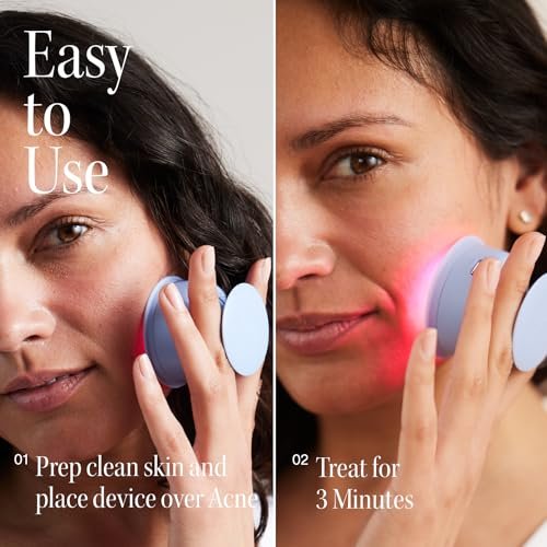 Solawave Bye Acne: Blue & Red Light Therapy Wand for Face & Body – LED Device Reduces Redness, Pimples, Zits & Blemishes, Calms Inflammation, 3-Min Treatment, Easy to Use Avelisse