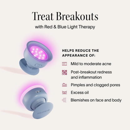 Solawave Bye Acne: Blue & Red Light Therapy Wand for Face & Body – LED Device Reduces Redness, Pimples, Zits & Blemishes, Calms Inflammation, 3-Min Treatment, Easy to Use Avelisse