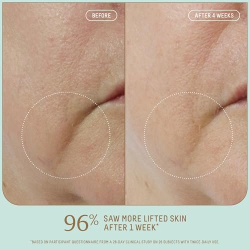 Biossance Squalane + Firm & Lift Dual Serum – Firming Face Serum for Maturing Skin with Hyaluronic Acid, Squalane, Ectoin, Gravetye Giant & Bisabolol – Reduces Wrinkles & Hydrates – 30ml Avelisse