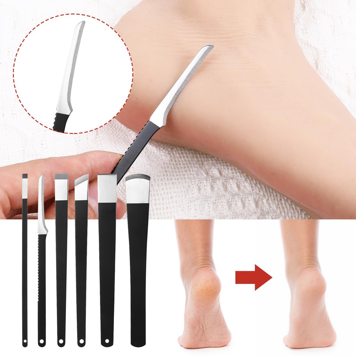 cobee 6-Piece Ingrown Toenail Removal Kit with Callus Shaver & Storage Box - Stainless Steel Foot Care Tool for Dead Skin, Corns, and Calluses - görsel 5