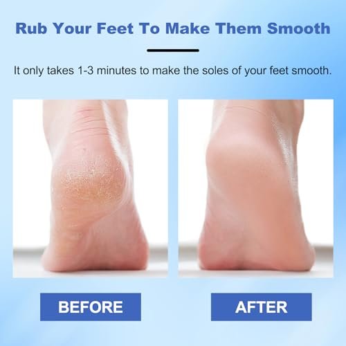 2-Pack Nano Glass Foot Files – Professional Hard Skin Remover with Ergonomic Handle (Gold + Blue) Avelisse