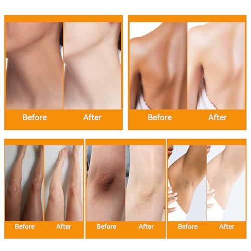 YAFUSIPE Dark Knuckle Remover Underarm Cream – Body Moisturizer Lotion for Armpit, Knees, Elbows, Inner Thigh, Neck, Private Parts – 4.21 fl oz (120 g) Avelisse