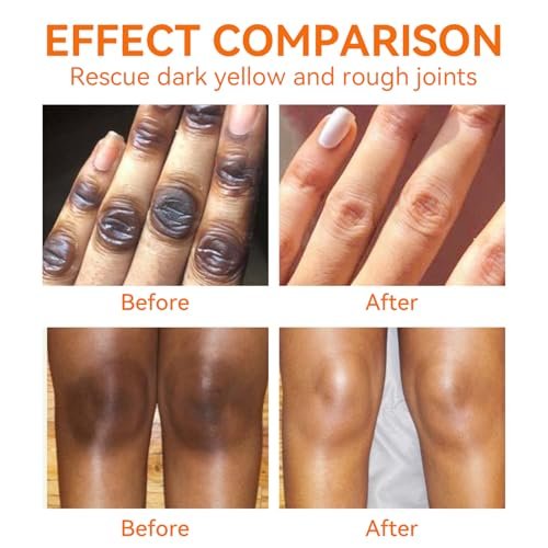 YAFUSIPE Dark Knuckle Remover Underarm Cream – Body Moisturizer Lotion for Armpit, Knees, Elbows, Inner Thigh, Neck, Private Parts – 4.21 fl oz (120 g) Avelisse