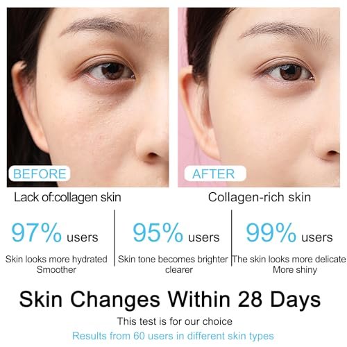 5% Hyaluronic Acid Serum Ultra Moisturizing & Elastic Skin - Wake Nature Perfection Hyaluronic Acid - Anti-Aging Serum for Face Single-Use Vials Skincare - Repair Sensitive Skin (1.5 ml)*30 Avelisse