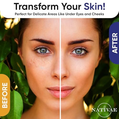 Milia Remover Treatment for Eyes & Face - Milia Spot Treatment with Salicylic Acid & Tea Tree Oil - Milia Acne Serum by Nativae Avelisse