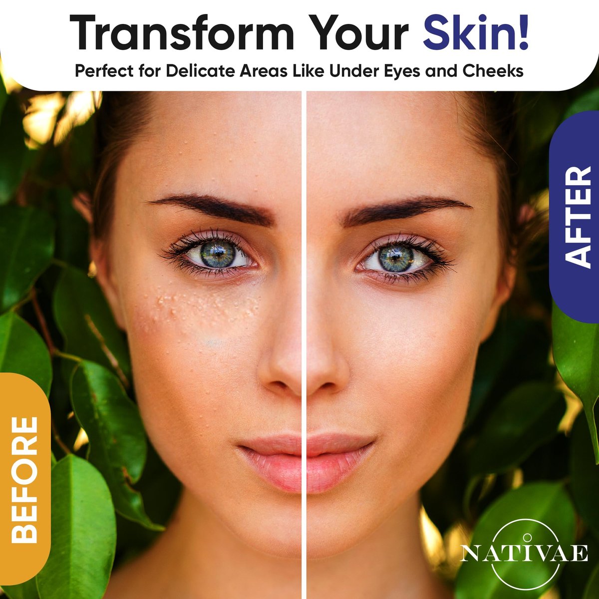 Milia Remover Treatment for Eyes & Face - Milia Spot Treatment with Salicylic Acid & Tea Tree Oil - Milia Acne Serum by Nativae Avelisse