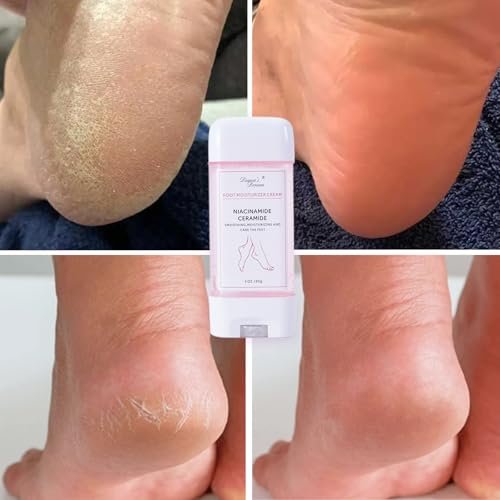 DIANA'S DREAM Foot Cream – Ultra-Hydrating Moisturizer for Dry, Cracked Heels & Feet – 3 oz - görsel 16