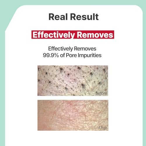 Illiyoon Gentle Deep Facial Cleanser | Low pH Gel-to-Foam Face Wash for Sensitive Skin, Hydrating Gel Cleanser & Daily Makeup Remover, Korean Skincare, 8.45 fl.oz. - görsel 8
