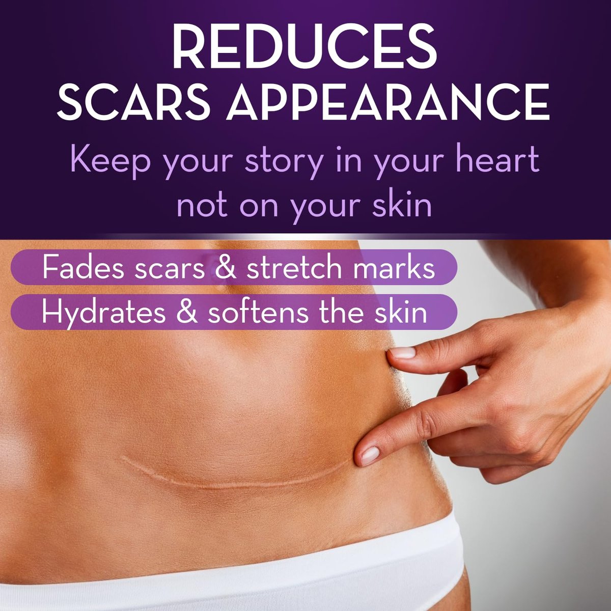 Cicatricure Advanced Scar Gel for Face & Body – Proven Results in 2 Weeks, Scar Treatment for Surgical Scars, Stretch Marks, Burns, Injuries & Acne Scars, 2 oz (56g) Avelisse