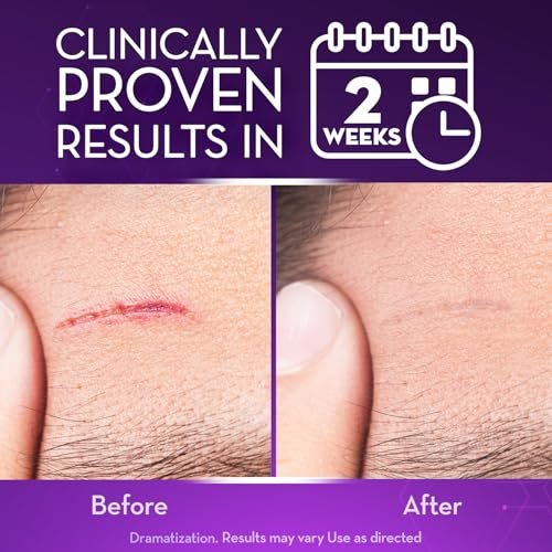 Cicatricure Advanced Scar Gel for Face & Body – Proven Results in 2 Weeks, Scar Treatment for Surgical Scars, Stretch Marks, Burns, Injuries & Acne Scars, 2 oz (56g) Avelisse