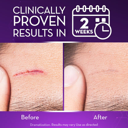 Cicatricure Advanced Scar Gel for Face & Body – Proven Results in 2 Weeks, Scar Treatment for Surgical Scars, Stretch Marks, Burns, Injuries & Acne Scars, 2 oz (56g) Avelisse