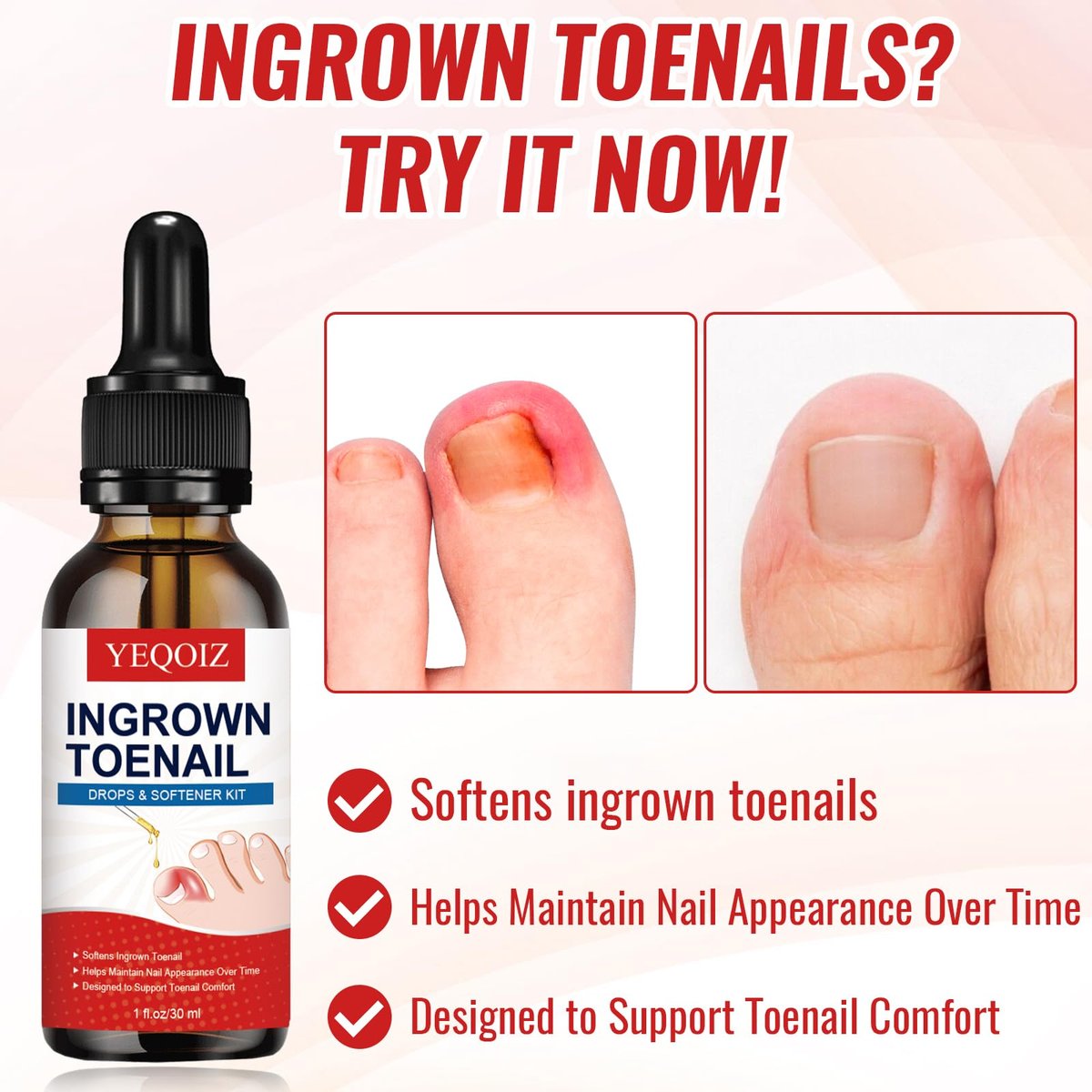 Ingrown Toenail Removal Kit – Complete Tool Set with Corrector, Drops, Patches, Clipper & File | YEQOIZ Avelisse