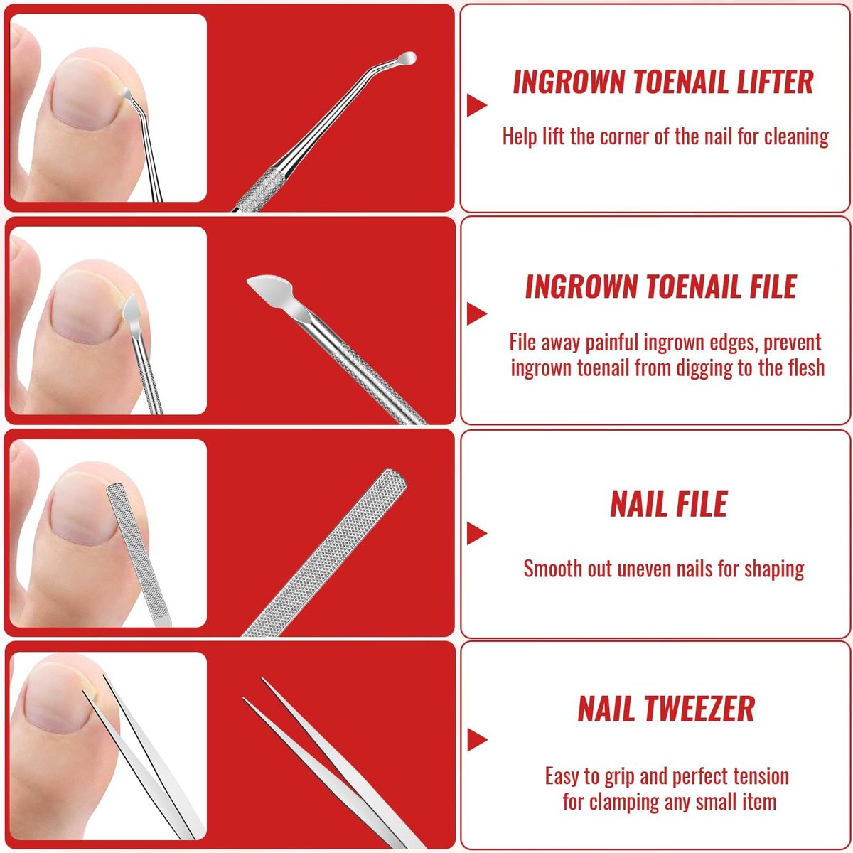 Ingrown Toenail Removal Kit – Complete Tool Set with Corrector, Drops, Patches, Clipper & File | YEQOIZ Avelisse