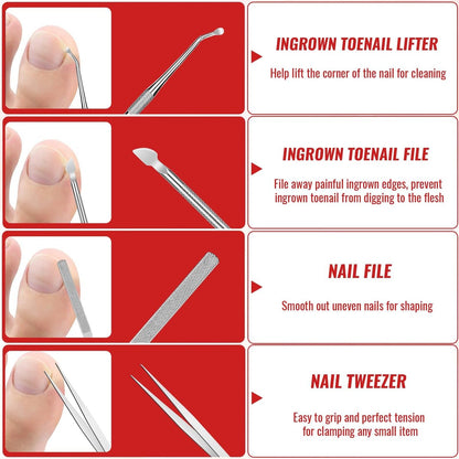 Ingrown Toenail Removal Kit – Complete Tool Set with Corrector, Drops, Patches, Clipper & File | YEQOIZ Avelisse