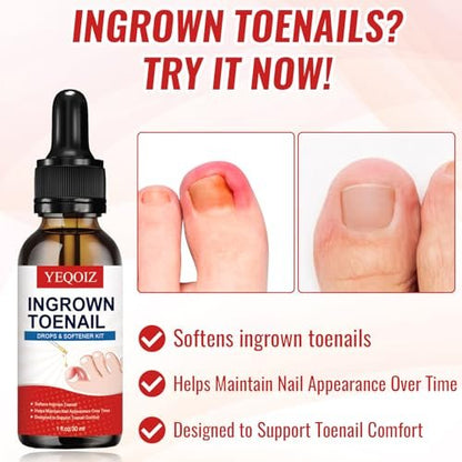 Ingrown Toenail Removal Kit – Complete Tool Set with Corrector, Drops, Patches, Clipper & File | YEQOIZ Avelisse