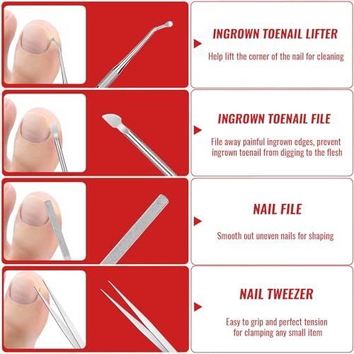 Ingrown Toenail Removal Kit – Complete Tool Set with Corrector, Drops, Patches, Clipper & File | YEQOIZ Avelisse