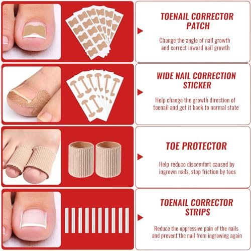 Ingrown Toenail Removal Kit – Complete Tool Set with Corrector, Drops, Patches, Clipper & File | YEQOIZ Avelisse