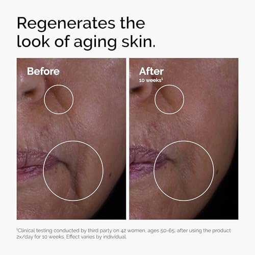 The Ordinary GF 15% Solution - Anti-Aging Serum for Visible Skin & Wrinkle Repair, 1 Fl Oz Avelisse