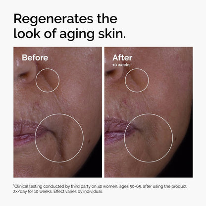 The Ordinary GF 15% Solution - Anti-Aging Serum for Visible Skin & Wrinkle Repair, 1 Fl Oz Avelisse