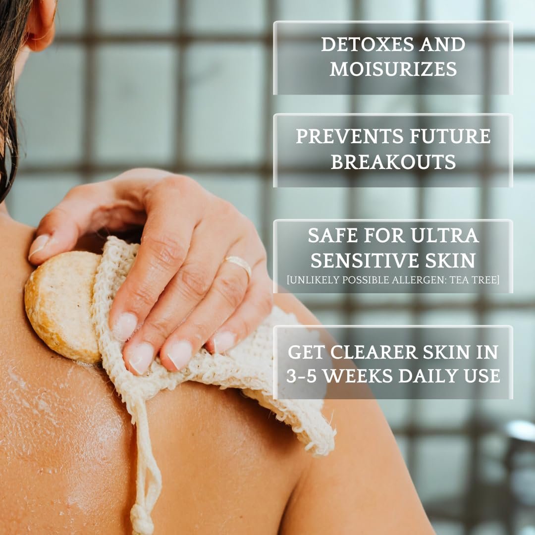 Bacne Wash: All Natural Back Acne Cleanser with Charcoal, Jojoba Oil, Tea Tree Oil, Neem Oil, Aloe Vera, Colloidal Oatmeal, and Vitamin E - Body Acne Wash for All Skin Types Avelisse