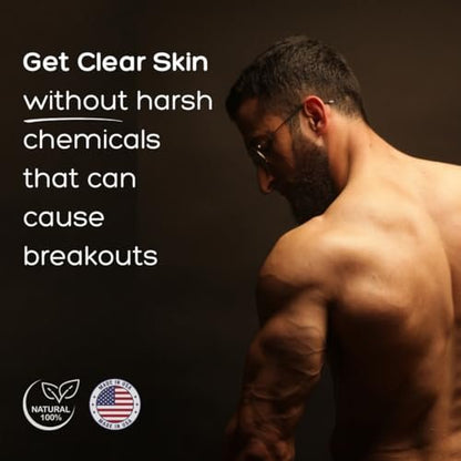 Bacne Wash: All Natural Back Acne Cleanser with Charcoal, Jojoba Oil, Tea Tree Oil, Neem Oil, Aloe Vera, Colloidal Oatmeal, and Vitamin E - Body Acne Wash for All Skin Types Avelisse