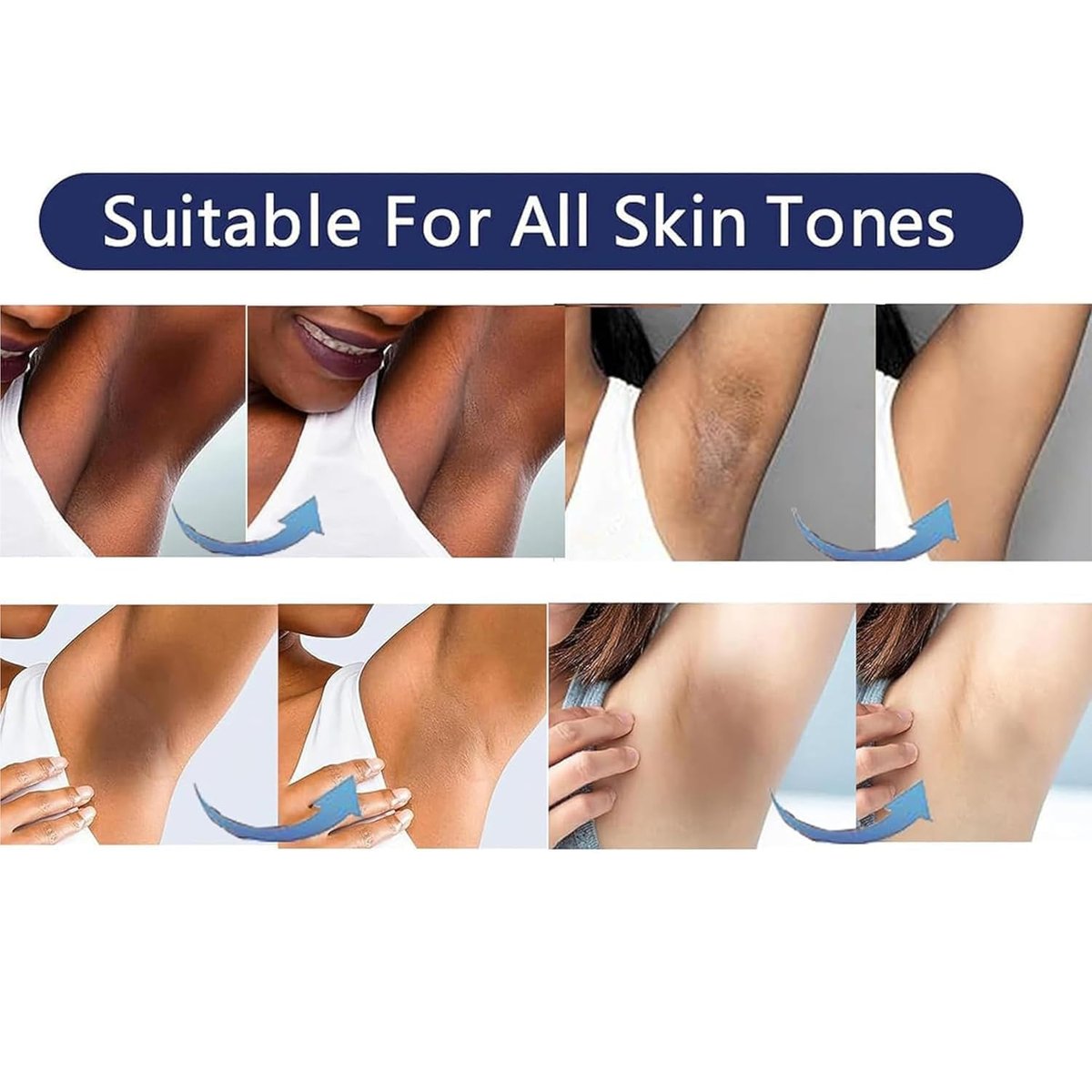 Gukei Skin Lightening Cream Gel for Body & Intimate Areas - Niacinamide, Arbutin, Vitamin C - Whitening for Underarms, Knees, Elbows, Inner Thighs, Bikini Line - 30ml - görsel 5