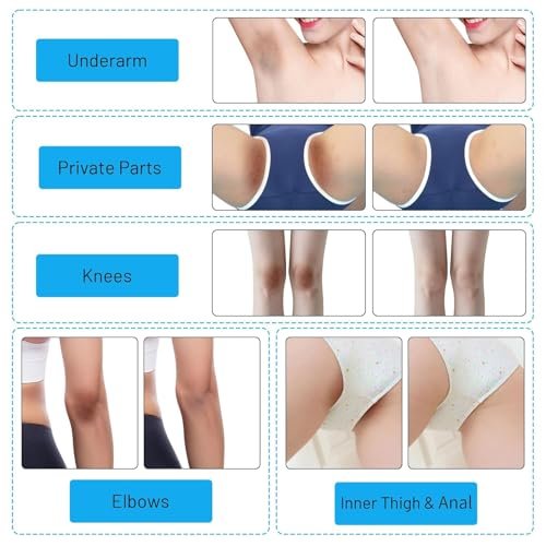 Gukei Skin Lightening Cream Gel for Body & Intimate Areas - Niacinamide, Arbutin, Vitamin C - Whitening for Underarms, Knees, Elbows, Inner Thighs, Bikini Line - 30ml - görsel 10