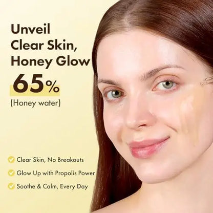 TOSOWOONG Honey Glow 65% Propolis Serum with Hyaluronic Acid, Kojic Acid, Niacinamide – Hydrating & Soothing Facial Serum for Uneven Skin Tone, Glass Skin, Korean Skincare, 33ml Avelisse