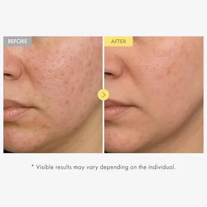 TOSOWOONG Honey Glow 65% Propolis Serum with Hyaluronic Acid, Kojic Acid, Niacinamide – Hydrating & Soothing Facial Serum for Uneven Skin Tone, Glass Skin, Korean Skincare, 33ml Avelisse
