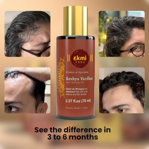 EKMIVEDA Ayurvedic Castor & Rosemary Oil for Hair Density - DHT Blocker, Hair Loss Treatment for Women & Men, 2.37 Fl Oz Avelisse