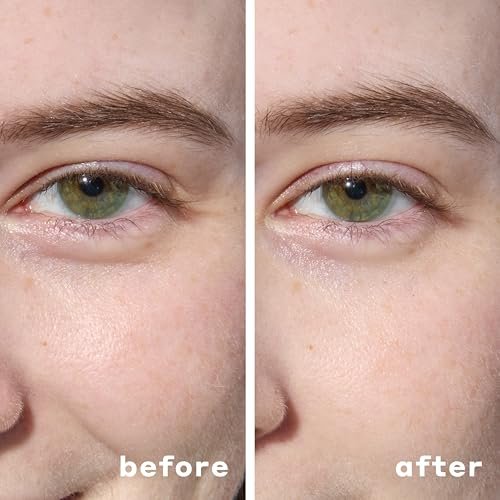 Mario Badescu Hydrogel Under Eye Patches – 30 Pairs Hydrating Eye Masks for Puffy Eyes, Dark Circles & Fine Lines with Hyaluronic Acid & Niacinamide Avelisse