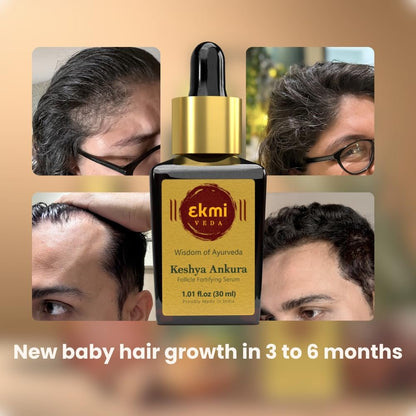 Ekmiveda Hair Growth DHT Blocker Serum with Redensyl, Procapil, Ayurvedic Herbs - Follicle Stimulating Hair Density Serum for Women & Men, 1.01 Fl Oz Avelisse