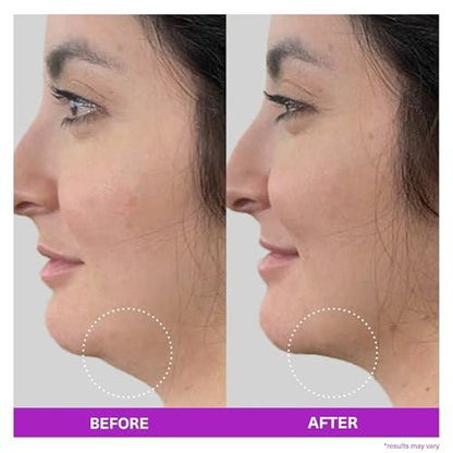 SickScience ShapeShift Advanced Jaw & Neck Firming Serum – Double Chin Reducer & Face Tightening Treatment with Exosome Technology for Men & Women, 1.7 oz Avelisse