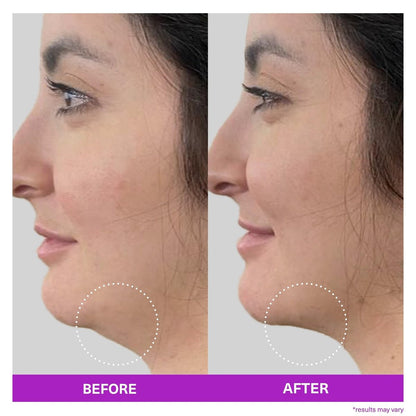SickScience ShapeShift Advanced Jaw & Neck Firming Serum – Double Chin Reducer & Face Tightening Treatment with Exosome Technology for Men & Women, 1.7 oz Avelisse
