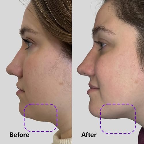 SickScience ShapeShift Advanced Jaw & Neck Firming Serum – Double Chin Reducer & Face Tightening Treatment with Exosome Technology for Men & Women, 1.7 oz Avelisse