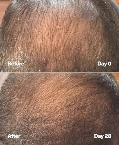 SickScience PowerCycle Exosome Hair Growth Serum – Clinically Advanced Scalp Treatment for Thinning Hair, Hair Loss Prevention & Regrowth, Lightweight Formula for Women & Men, Without Minoxidil, 60mL Avelisse