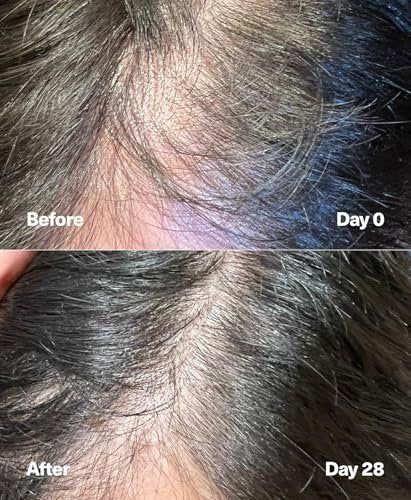 SickScience PowerCycle Exosome Hair Growth Serum – Clinically Advanced Scalp Treatment for Thinning Hair, Hair Loss Prevention & Regrowth, Lightweight Formula for Women & Men, Without Minoxidil, 60mL Avelisse
