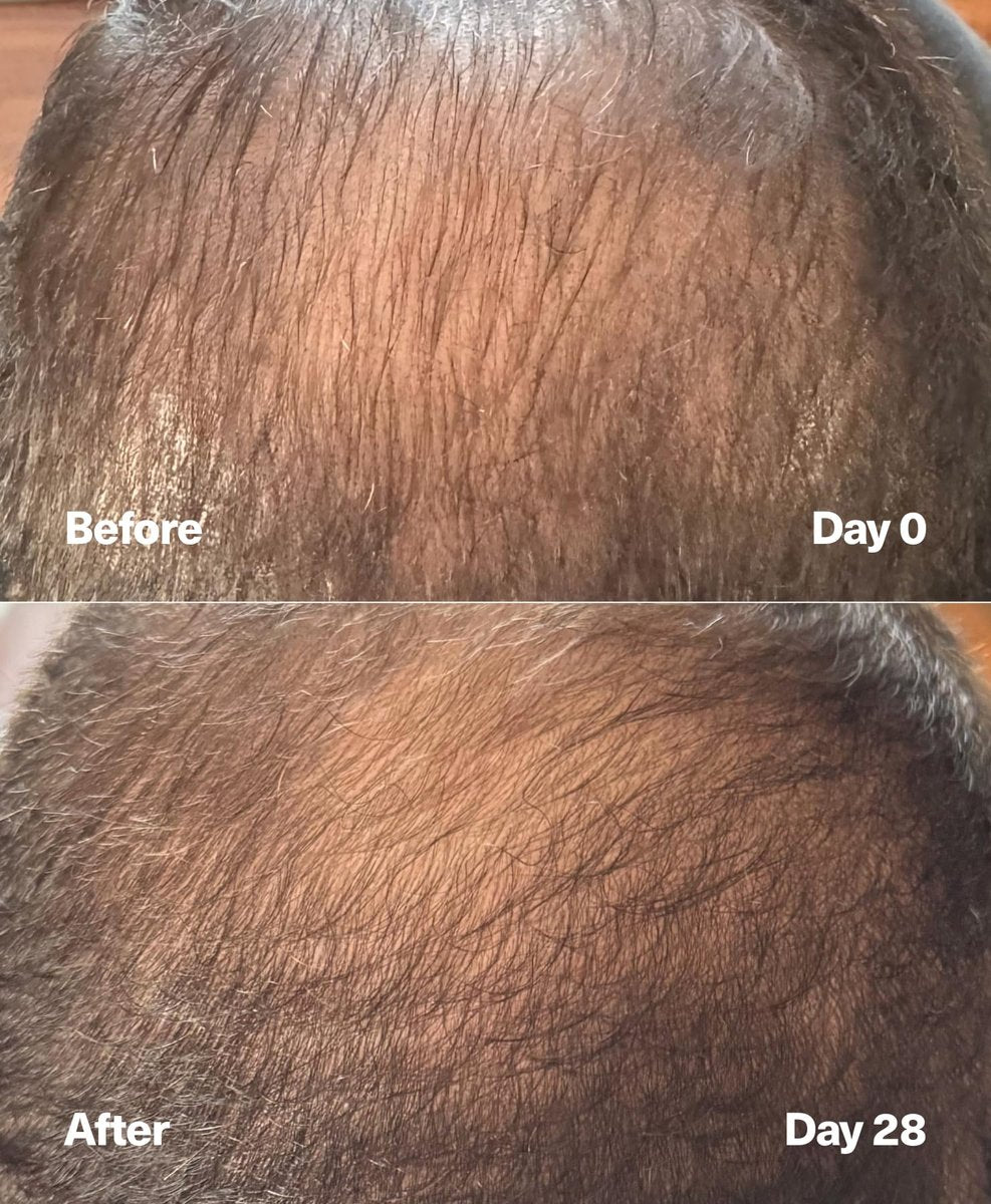 SickScience PowerCycle Exosome Hair Growth Serum – Clinically Advanced Scalp Treatment for Thinning Hair, Hair Loss Prevention & Regrowth, Lightweight Formula for Women & Men, Without Minoxidil, 60mL Avelisse