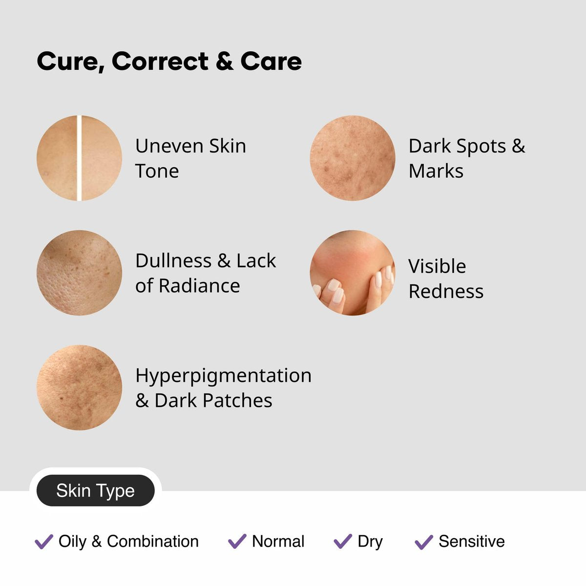 Cureskin Tranexamic Acid 10% Cream - Dark Spot Corrector with Kojic Acid & Alpha Arbutin (15g) Avelisse