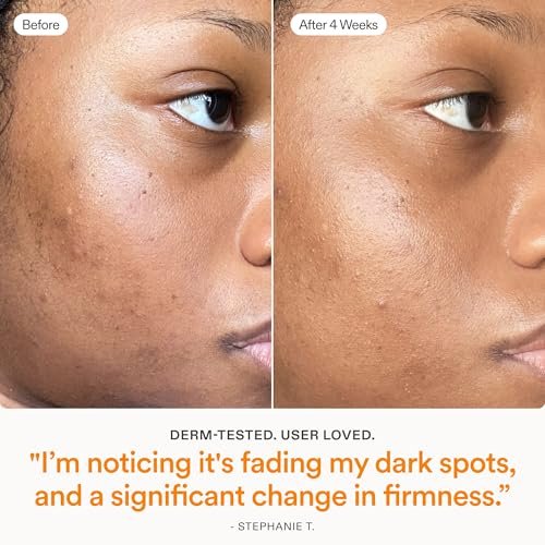 Skinfix Brighten + Firm 15% Vitamin C Serum for Face - Fades Dark Spots & Fine Lines - Safe for Sensitive & Aging Skin Avelisse