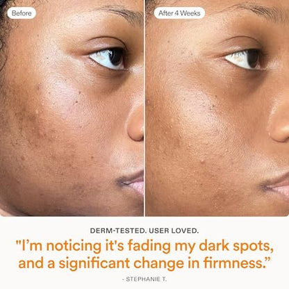 Skinfix Brighten + Firm 15% Vitamin C Serum for Face - Fades Dark Spots & Fine Lines - Safe for Sensitive & Aging Skin Avelisse