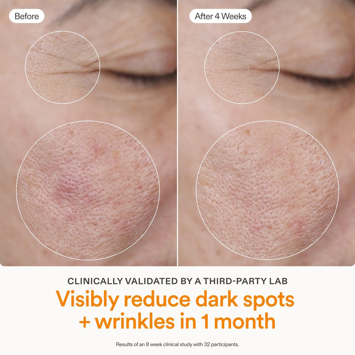Skinfix Brighten + Firm 15% Vitamin C Serum for Face - Fades Dark Spots & Fine Lines - Safe for Sensitive & Aging Skin Avelisse