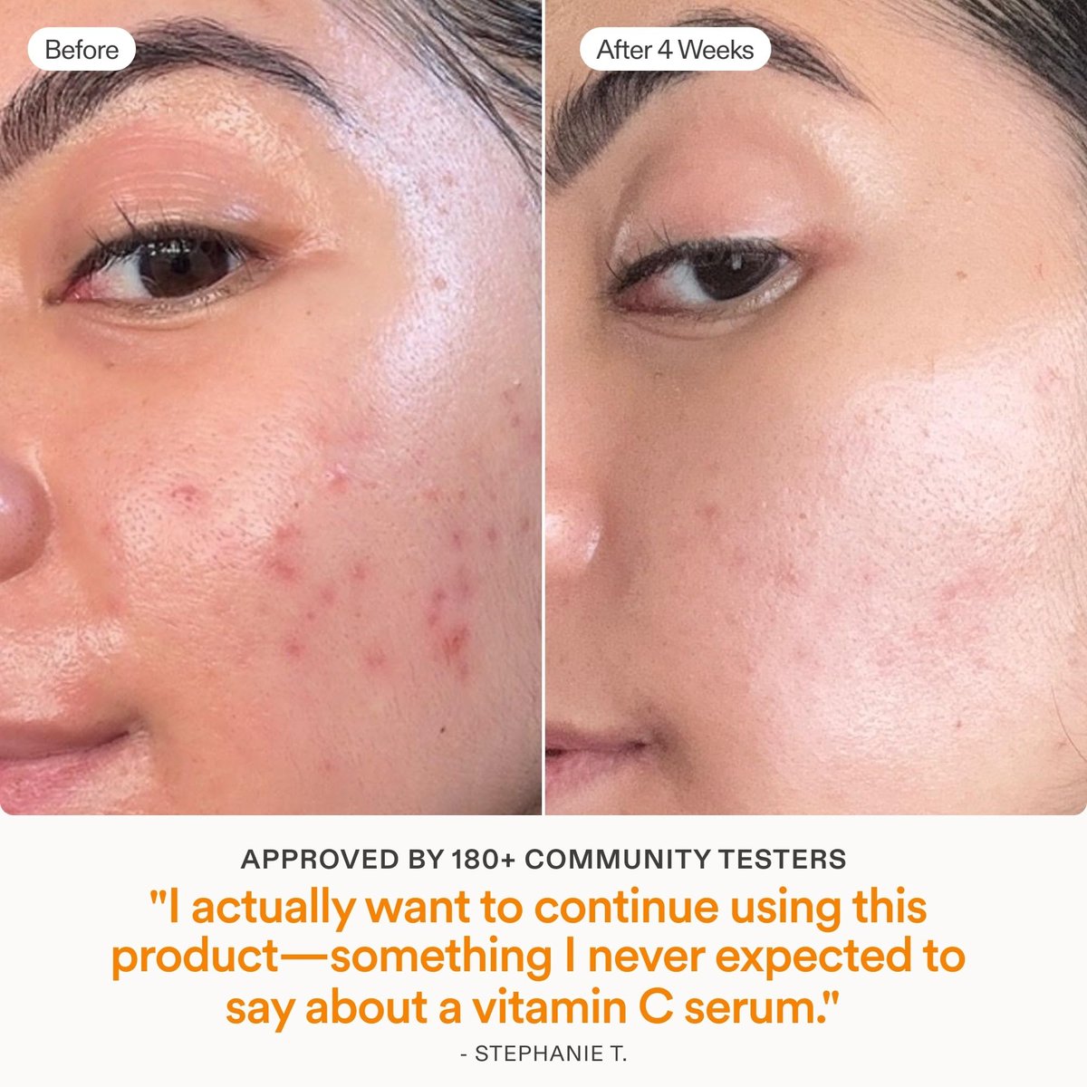 Skinfix Brighten + Firm 15% Vitamin C Serum for Face - Fades Dark Spots & Fine Lines - Safe for Sensitive & Aging Skin Avelisse