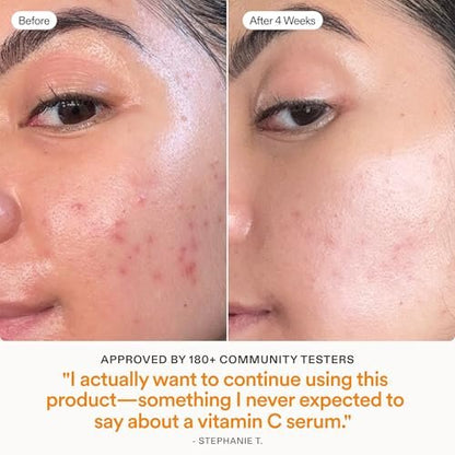 Skinfix Brighten + Firm 15% Vitamin C Serum for Face - Fades Dark Spots & Fine Lines - Safe for Sensitive & Aging Skin Avelisse