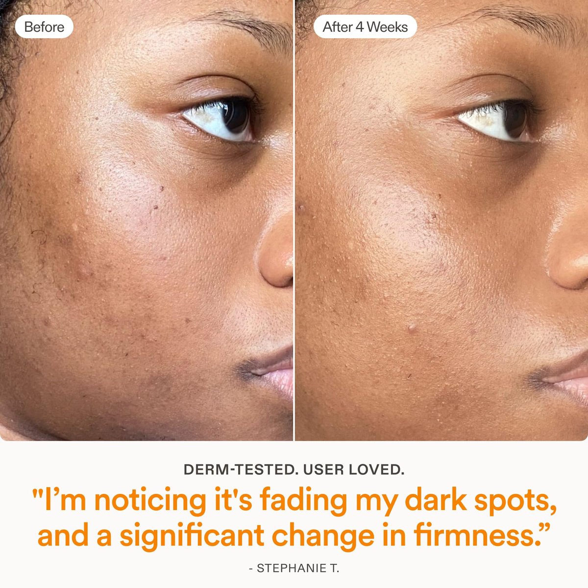 Skinfix Brighten + Firm 15% Vitamin C Serum for Face - Fades Dark Spots & Fine Lines - Safe for Sensitive & Aging Skin Avelisse