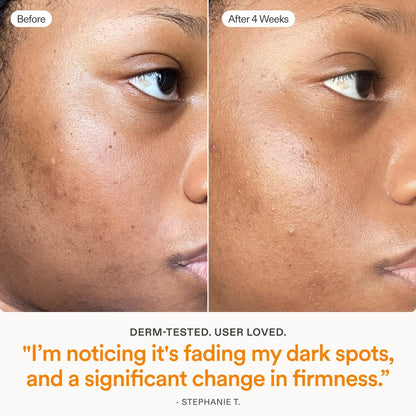 Skinfix Brighten + Firm 15% Vitamin C Serum for Face - Fades Dark Spots & Fine Lines - Safe for Sensitive & Aging Skin Avelisse