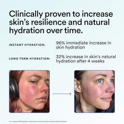 Experiment Super Saturated Ultra Hydrating Barrier Serum – 30% Glycerin, Polyglutamic Acid + Prickly Pear – 1.35 FL OZ – Intensive Moisture for Plump, Dewy Skin – Hydrating Serum for All Skin Types Avelisse