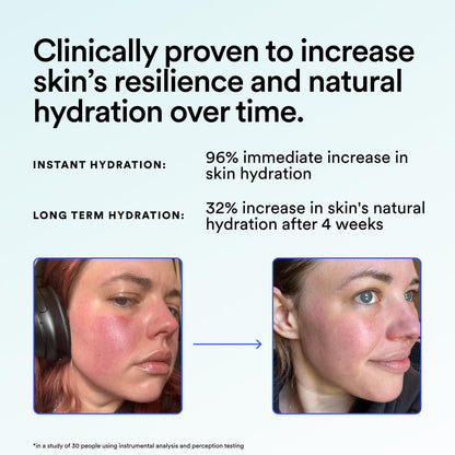 Experiment Super Saturated Ultra Hydrating Barrier Serum – 30% Glycerin, Polyglutamic Acid + Prickly Pear – 1.35 FL OZ – Intensive Moisture for Plump, Dewy Skin – Hydrating Serum for All Skin Types Avelisse