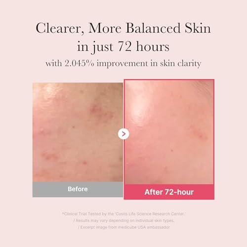 Medicube TXA+Niacinamide 15% Glow Facial Serum for After Spot Care | All-in-One Daily Korean Skincare | Uneven Skin Tone, Texture, and Hydration Care | High-Potency Tranexamic Acid 5% | 1.01 fl.oz Avelisse
