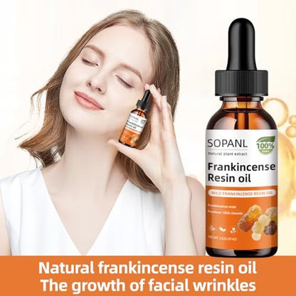 Organic Frankincense Resin Oil for Face - Reduces Fine Lines & Wrinkles, Soothes Irritated Skin, Deep Hydration for All Skin Types, Daily Skincare, 2 Fl Oz Avelisse